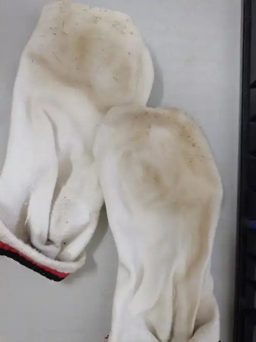 白衣服和白袜子发黄怎么办?