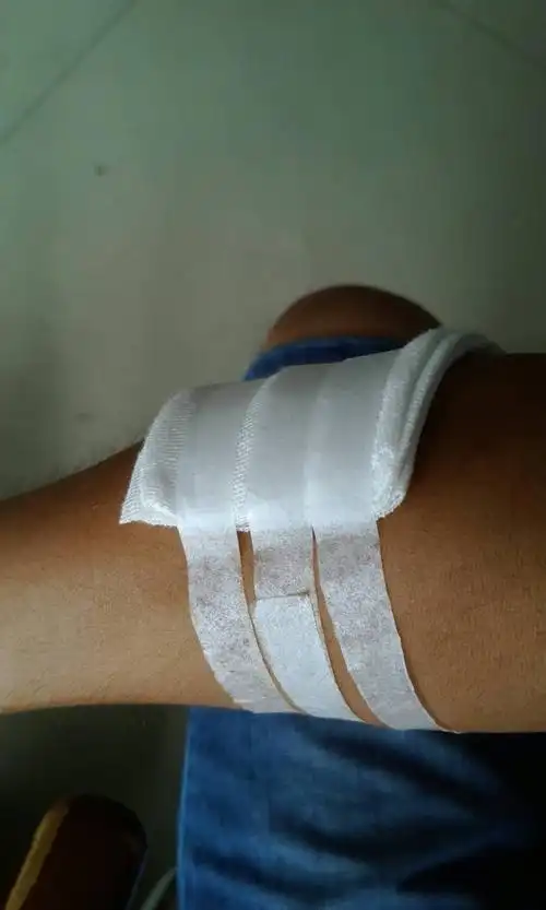 包扎腿部伤口图片