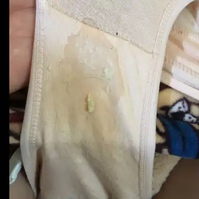 孕38周 2最近两天都出现这个,是白带还是什麼?是不是要生了