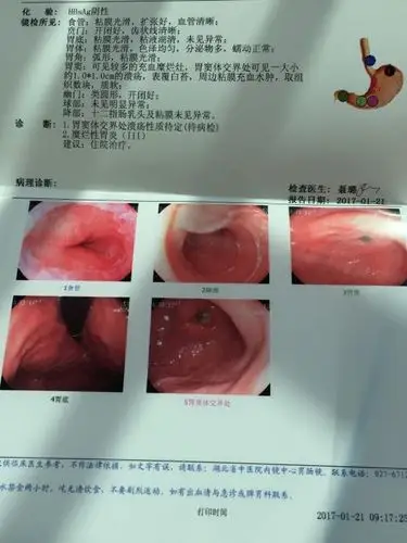 妈妈的胃镜检查结果,会是胃癌吗?