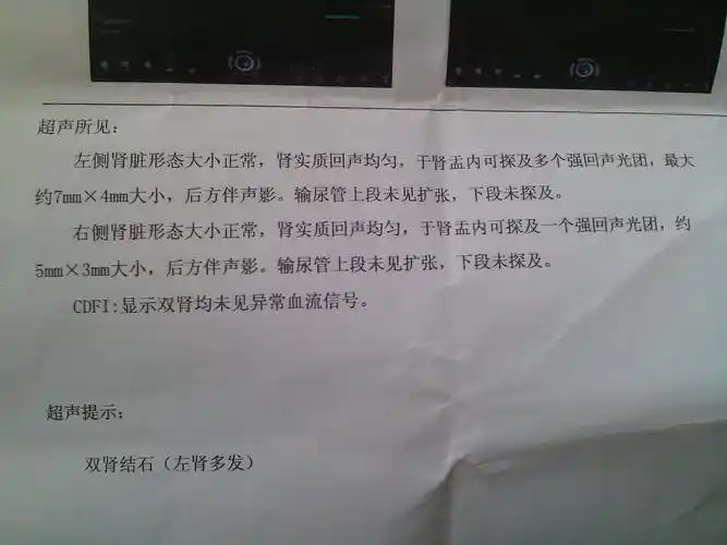 问:谁给看一下2张肾结石彩色超声检查报告单,同一人的,分别是5月与8月