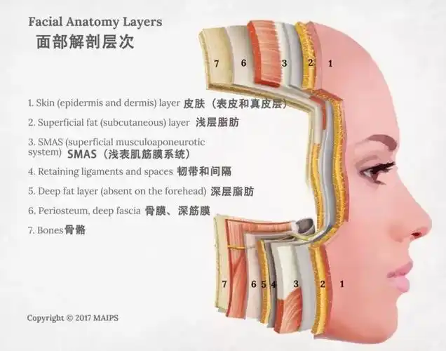 不同部位埋到不同的层次.