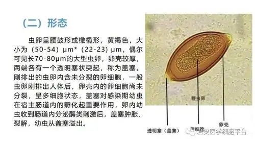 鞭虫及其虫卵美图鉴赏之升级版