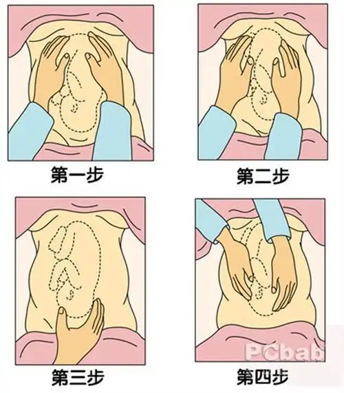 孕妇胎位不正什么原因造成的