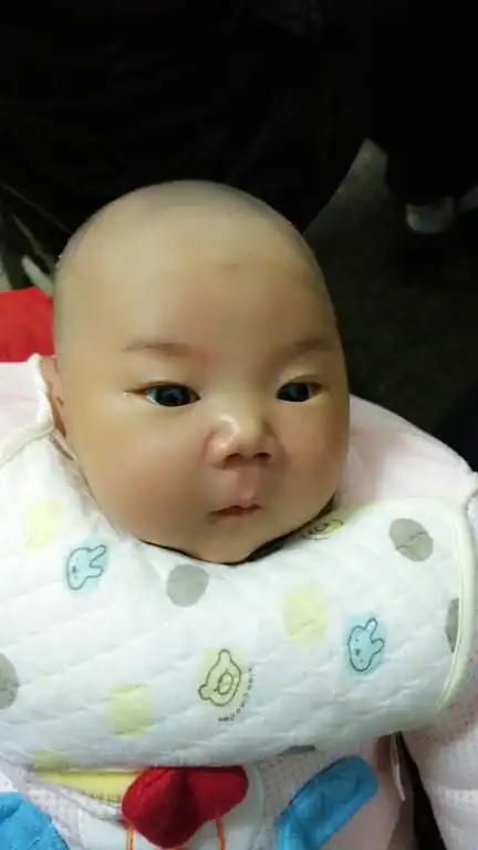 有没有眼距宽的宝宝?