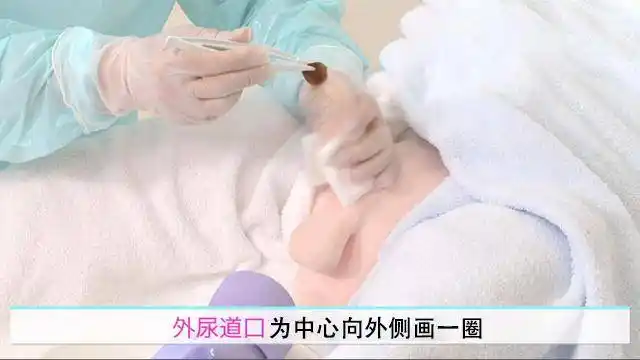 男性导尿有何技巧?