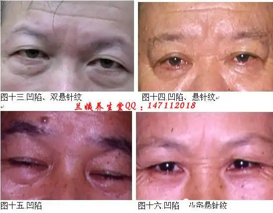 印堂反应出来的问题来对号入座吧