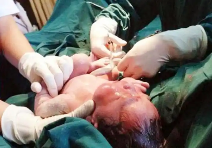 37周足月和40周足月有差异吗宝宝这个器官发育不完善健康度低