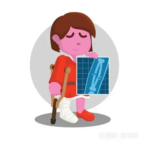 小女孩受伤的腿显示他的x射线结果