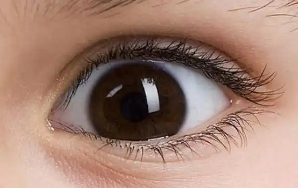 中国人的眼球有棕色的吗?,为什么我的眼球是棕色的?