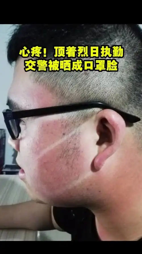 心疼!顶着烈日执勤,交警被晒成口罩脸.