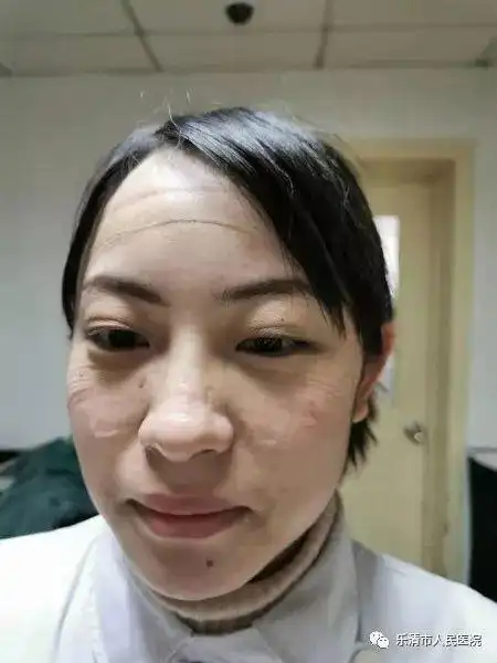 乐清最美的脸!他们摘下口罩的样子,让人心疼