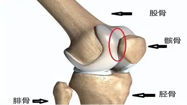 我们的膝关节主要由三块骨头组成,分别是股骨,胫骨和髌骨,其中髌骨是