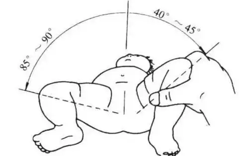 宝宝平躺,双腿屈膝两脚放在床上,如双膝高低相等为正常,单髋关节脱位