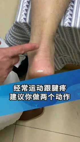 跟腱滑囊炎,经常穿高跟鞋90的女孩子和爱运动爱健康的人比较多发