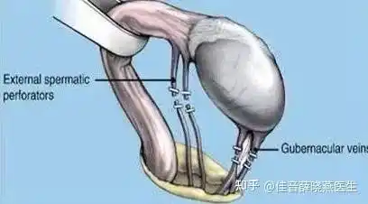 精索静脉曲张 一定要切蛋蛋?_影响_阴囊_手术