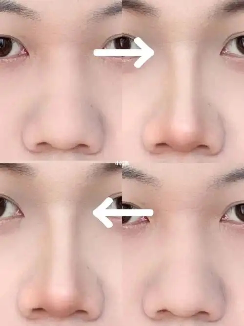 有效缩窄大鼻头宽鼻背的修容蒜头鼻进来抄