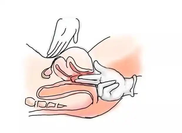 妇科检查操作流程