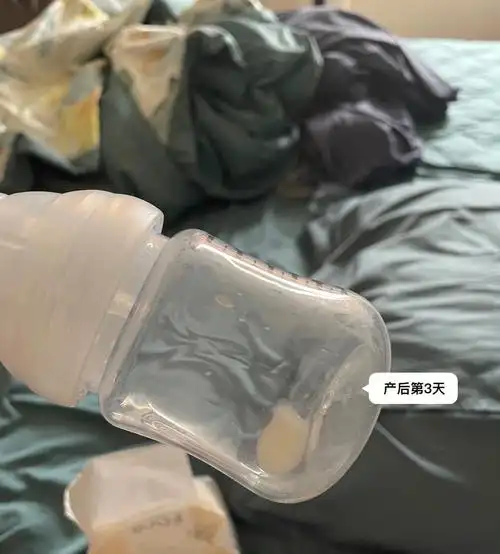 产后3天生理性涨奶