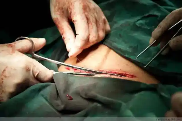 古代,孕妇产子仿若走了一道鬼门关;然而在科技发达的现在,生个孩子也