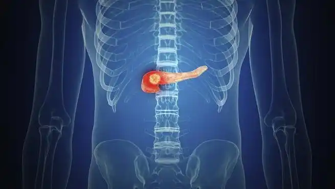 胰腺疼痛位置图片