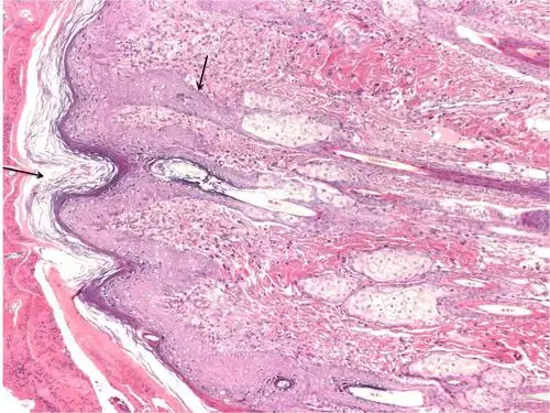 求大神帮忙指导------大鼠皮肤he染色图