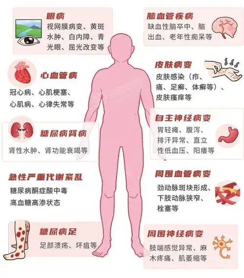 柳叶刀:30岁患糖尿病,寿命或缩短14年|高血糖|并发症|2型糖尿病|全国