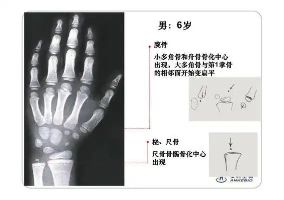 骨龄图谱2016版(最终版)