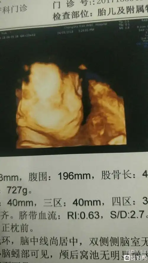 流程!100%生男孩的症状"值得信赖"-第2张图片-米兔博客