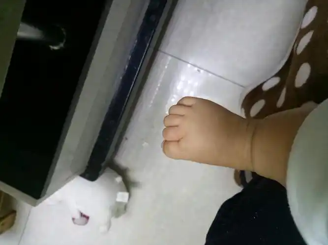 宝宝三个多月了,脚指头老是勾着是怎么回事?