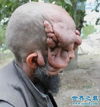 盘点世界上最丑的男人娶2个老婆生8个孩子