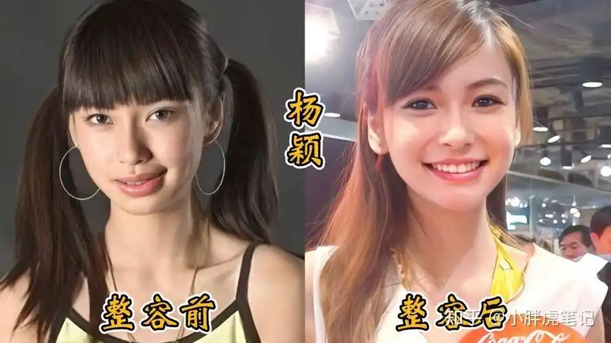 18位女明星整容前后对比,邵音音面目全非,杨颖堪称整容模板!