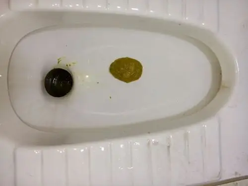 我突然肚子痛,就去大便,但大便的颜色不对劲,和拉出去来是糊的样子