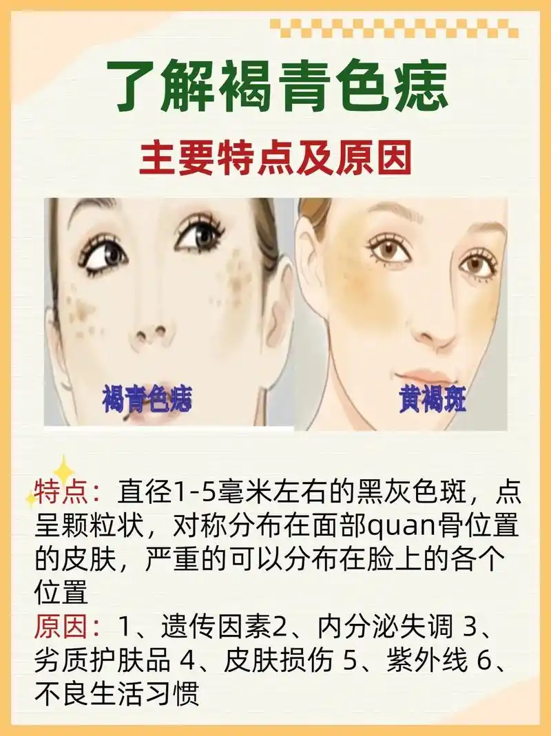 教你区分黄褐斑和褐青色痣.#变美小技巧 #护肤 #美白淡斑  - 抖音