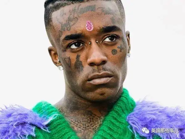 还记得那个往脑门镶颗大粉钻的美国rapper么!结果被粉丝抠掉了?