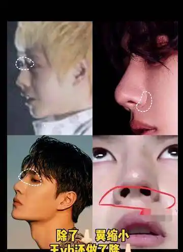 原创王一博机场生图曝光脸和脖子比例不佳山根粗大鼻子发黑被吐槽