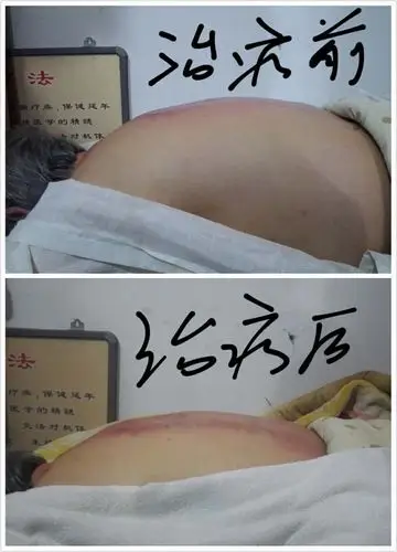 背厚1公分,人显老3岁!