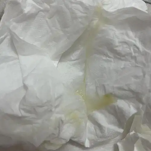 求助一下没有过性生活但白带黄粘