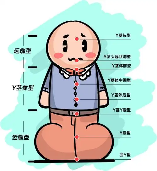 辨别男孩丁丁是否尿道下裂畸形看这3个异常表现