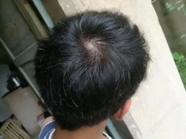 头顶几个旋,有什么特殊意义?有两个旋的人会更聪明吗?