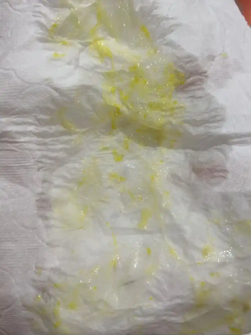 宝宝吐奶吐出来好多痰 宝宝咳嗽有段时间了,这几天一直在吃易坦静,做