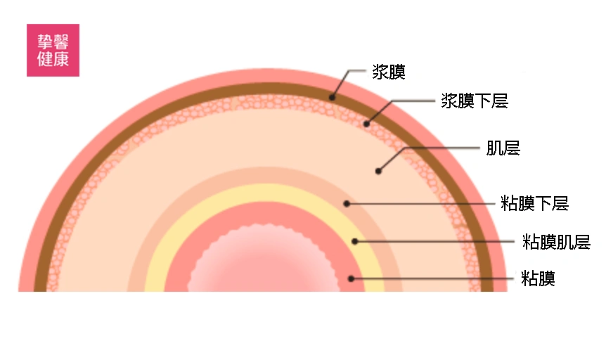 从大肠壁内侧开始,由粘膜,粘膜肌层,粘膜下层,固有肌层,浆膜下层和