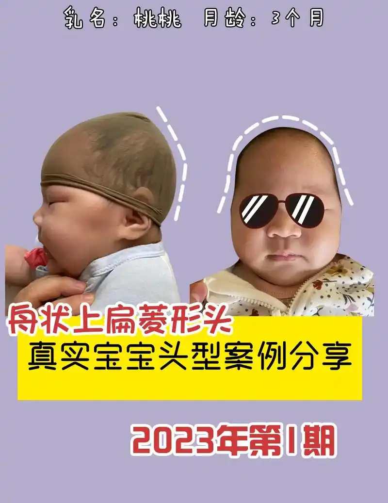 创作灵感 周状上扁菱形头真实案例分享73#星菲妈妈看头型 # - 抖音