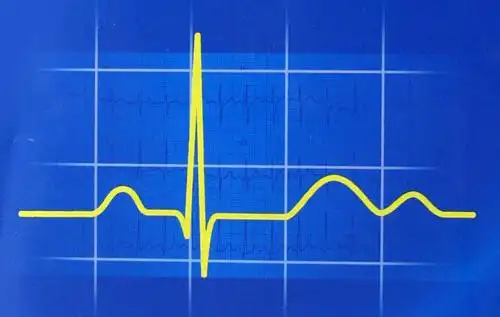 (活人的心电图)