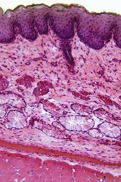 复层鳞状上皮照片
