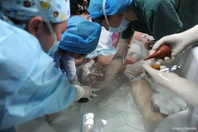 生孩子是选择妇幼保健还是公立医院?听妇产科护士长亲戚这样说!