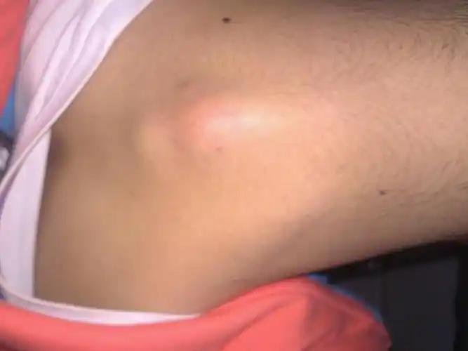 上次脖子握了一下,脊椎骨有点凸出来了,深呼吸时胸部非常难受,怎么办?