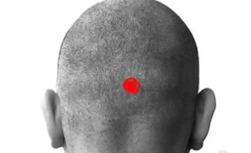 反骨来自于面相学说,指的是后脑勺位置有一块骨头凸起或者额头特别