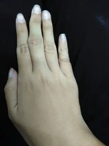 我的手指有点歪,是因为握笔姿势造成的吗?