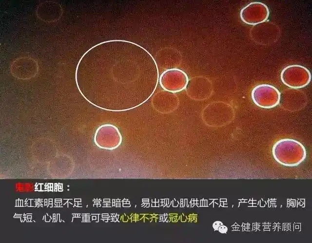 【视频】金健康一滴血检测,为什么可以分析出你的健康状况?